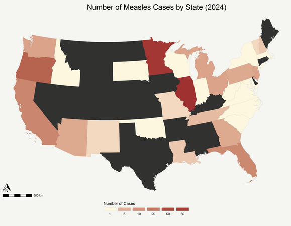 Measles cases by state (2024) (R Studio)