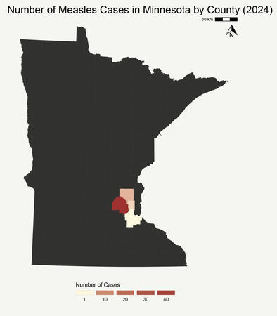 Minnesota Measles Cases 2024 (RStudio)